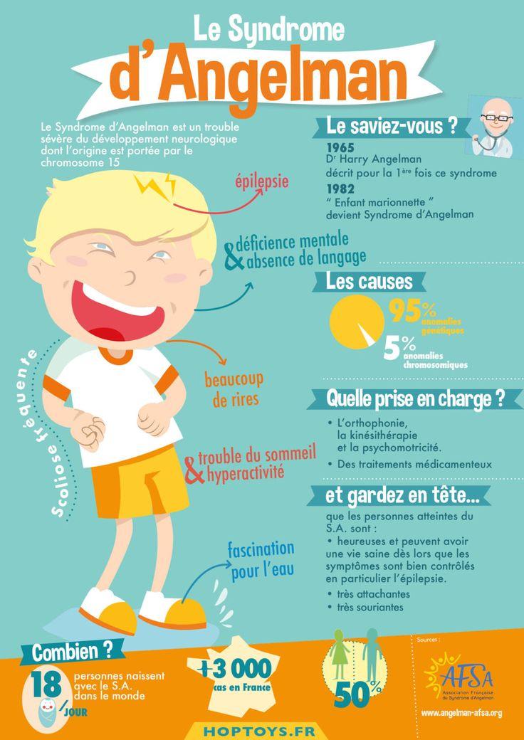 Infographie le syndrome d angelman