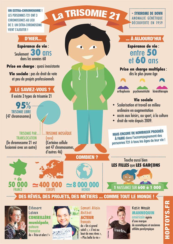 La trisomie 21 en une infographie
